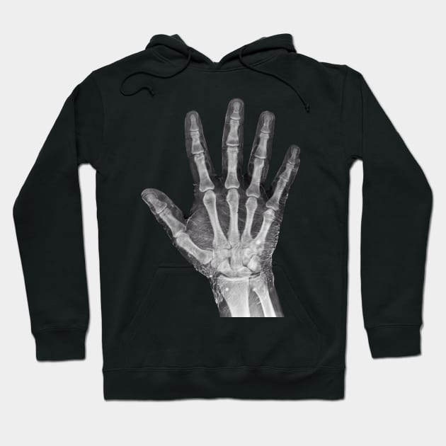 Radiologists Favorite X-ray Hand Hoodie by labstud